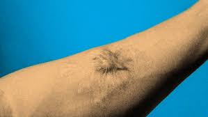 How To Reduce The Appearance Of Scars - Dollar Shave Club Original Content