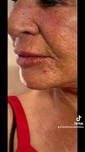 This sweet lady came in...