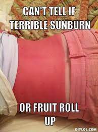 Sun Burn Funny Quotes Quotesgram