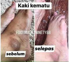 Buku lali hitam, dah putih. Buku Lali Hitam Kematu Let S Syantik Syantik Facebook