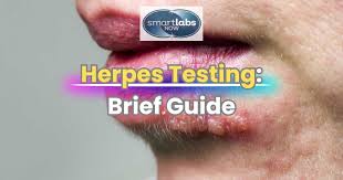 Image result for Herpes Simplex Virus Testing