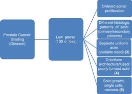 However, as with other types of cancer,. Gleason Grading Of Prostate Cancer Chapter 5 Pathology Of The Prostate