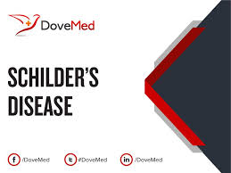 When ms destroys the myelin, these messages may be slowed or even completely blocked. Schilder S Disease