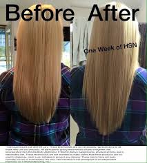 Biotin Before And After Hair This Amazing Before And After Is With Only One Week Of Taking Our Hair Skin And Nails There Are Many Replica Versions Of Longer Stronger Hair Hair Skin Hair