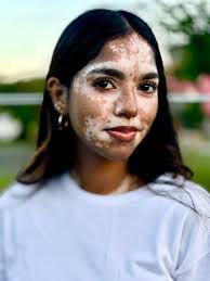 Eric Eustace's Instagram, Twitter & Facebook