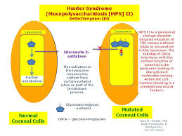 Mps diseases are extremely rare, and it is understandable that individual healthcare providers are not necessarily knowledgeable or experienced. Hunter Syndrome Mps Ii Hereditary Ocular Diseases