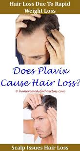 Pin On Hair Loss