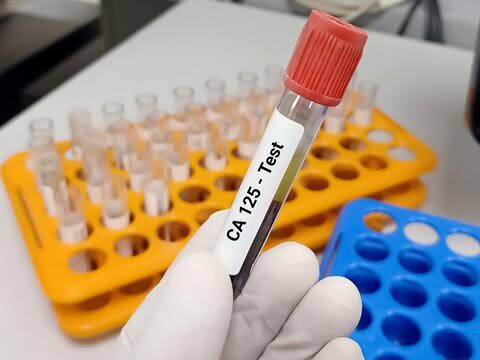 CA 125 product image
