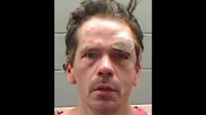 Deputy Stabbed by Suspect With Needle