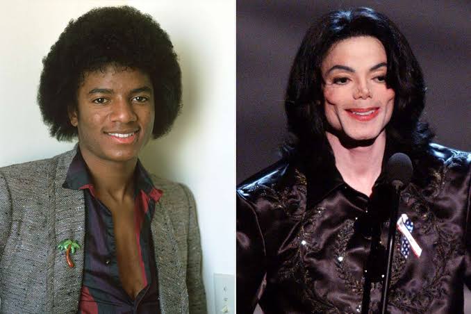 Michael Jackson's Plastic Surgery: Everything He's Revealed About His  Procedures