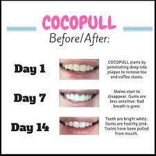 They'll polish the stains off of your teeth to give you. Pin On Starting Keto