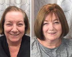 Best Hair Toppers For Women With Thinning Hair Or Hair Loss How To Get Instant Volume To Crea Hair Toppers Hairstyles For Thin Hair Thin Hair Styles For Women