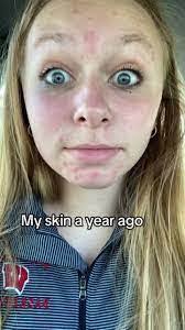 Chantelle Worthington's Instagram, Twitter & Facebook