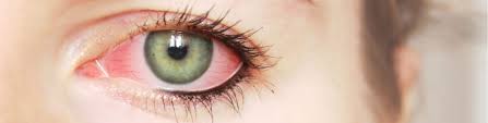 What is an eye doctor? Eyecare Elements Bellevue Washington Eye Doctors Eye Care