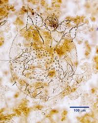 Image result for Sarcoptes scabiei life cycle