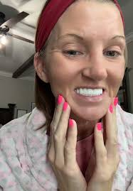 Navigating Denture Challenges: A Personal Journey