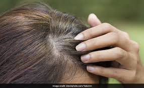 You don't have to eat exotic, expensive fruit and vegetables. Hence Proved Stress Can Cause Greying Of Hair