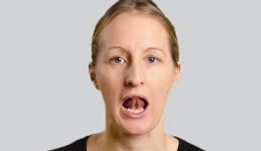 ReaDySpeech for people with dysarthria after stroke: feasibility of the  intervention