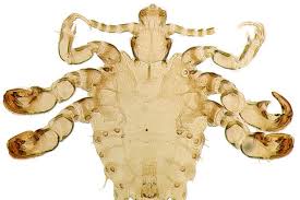 Image result for pubic lice symptoms