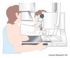 A technician will place the breast between two plates. Breast Screening Breast Cancer Cancer Research Uk