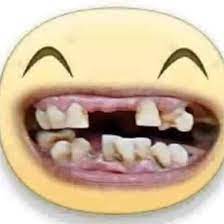 مراحل اصلاح وتغيير اسنان مسوسة كليا عند طبيب الاسنان بتقنيات جديدة. Ø§Ø³Ù†Ø§Ù† Ø§Ù„Ø¹Ø±Ø¨ Ù…Ø³ÙˆØ³Ù‡ On Twitter Ø²Ù‡Ù‚Ù†Ø§ Ù…Ù† Ø§Ù„Ø³Ù„Ø·Ù‡ Ø§Ù„Ù„Ù‡ ÙŠØ®Ø°Ùƒ ÙŠØ§ Ø¹Ø¨Ø§Ø³