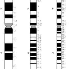 Two copies of chromosome 14, one copy inherited from each parent, form one of the. Pdf Karyotype Analysis And Chromosome Banding