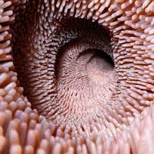 Image result for Intestinal Enteropathy