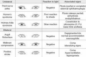 Image Result For Pupil Size Chart Optometry School Eye