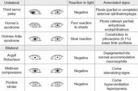 image result for pupil size chart optometry school eye