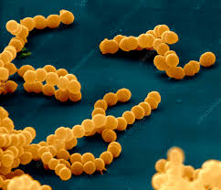 Image result for Streptococcus