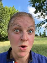 how to clearskin without using rejuv?