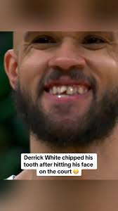 #DerrickWhite #BostonCeltics #ESPNNBAPlayoffs #Basketball #NBAFinals #Teeth