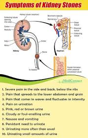 Signs And Symptoms Of Kidney Stones Kidney Health Kidney Stones Symptoms Health Facts