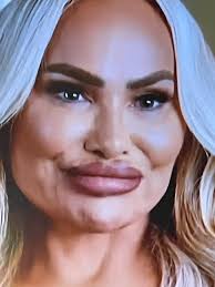 Criticism of Darcey and Stacey's appearance after plastic surgery