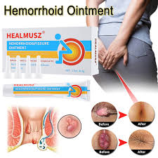 Image result for Hemorrhoid