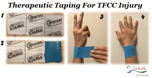 Injuries of the tfcc were broadly classified by palmer as traumatic and degenerative, with traumatic lesions it is estimated that tfcc injury occurs in up to 80% of displaced distal radius fractures. Rehabilitation For Tfcc Injury Rehab For A Better Life