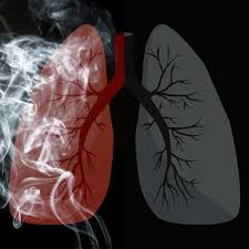 Image result for Pulmonary Intoxicant