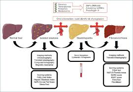 Image result for BARD Score