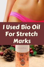 Bio Oil Stretch Marks Before And After I Used Bio Oil For Stretch Marks Every Day Here Is What You Should Know Oil For Stretch Marks Bio Oil Stretch Marks