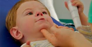 Franceschetti syndrome is an autosomal dominant disorder of craniofacial development with variable expressivity. Erfahrungen