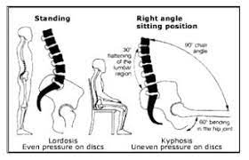 Pin On Squat Seating