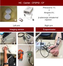 Image result for Sweat Chloride