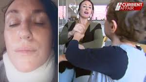 Mother of autistic child files landmark case against the NDIA