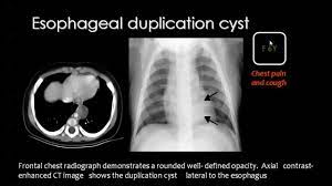 Pin By Dr Abuaiad On Pediatrics Human Anatomy And Physiology Pet Ct Anatomy And Physiology