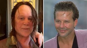 Mickey Rourke before and after: His plastic surgery transformation  explained