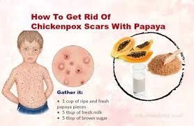 Pin On Health Tips