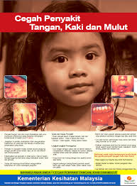 Sebenarnya nama lainnya ialah sakit tangan, kaki dan mulut (hand, foot and mouth disease). Situasi Semasa Kejadian Penyakit Tangan Kaki Dan Mulut Hfmd Di Malaysia Kkm The Malaysian Medical Gazette