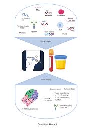 These include your blood pressure, heart rate and metab. Ijms Free Full Text Glycans As Biomarkers In Prostate Cancer Html