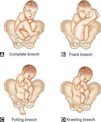 Image result for Compound Presentation