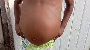 Fundraiser by Prisca Dim Okolie : Support Ian in His Fight Against Kidney  Disease